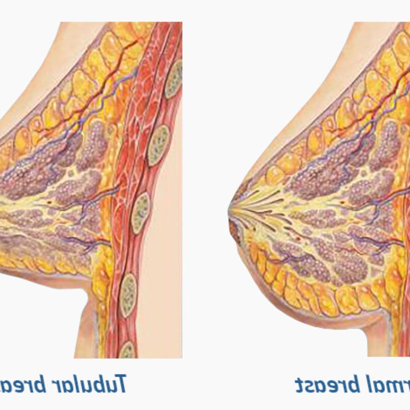 Understanding Tubular 乳房s